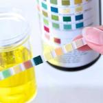 BANDELETTE URINAIRE 2P GLUCOSE ACETONE