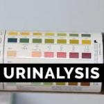 Bandelettes urinaires 13 paramètres (HEALGEN)